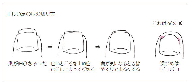 正しい足の爪の切り方